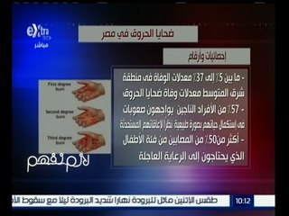 لازم نفهم | إنفوجرافيك | ضحايا الحروق في مصر