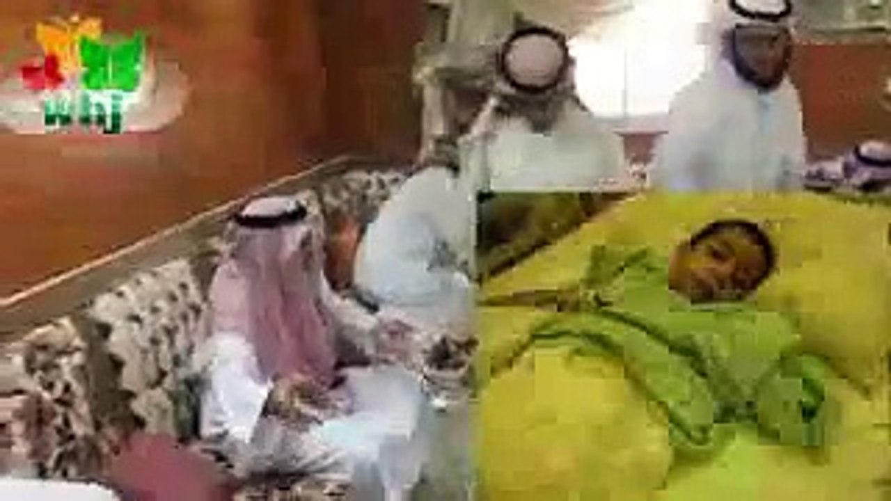 مشهد تمثيلي من قصة حقيقية : انقطعت يد الطفل بسبب ماذا ؟