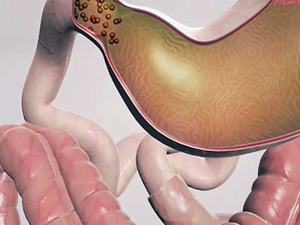 Aprende a cuidar tu intestino-