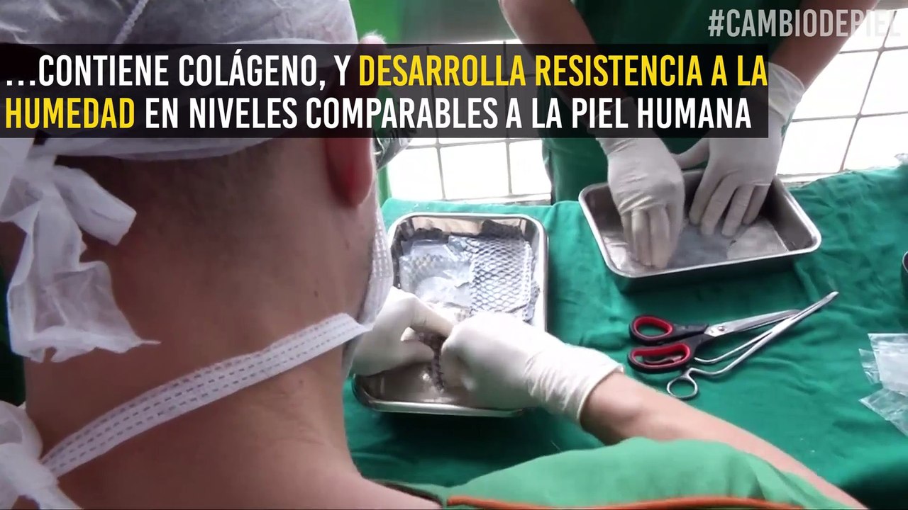 ¿Te lo aplicarías? Este tratamiento utiliza piel de pescado para sanar quemaduras