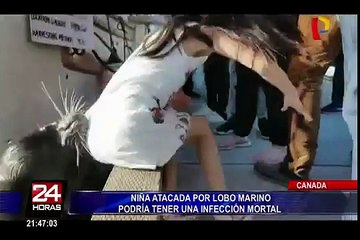 Canadá: niña atacada por lobo marino podría tener infección mortal