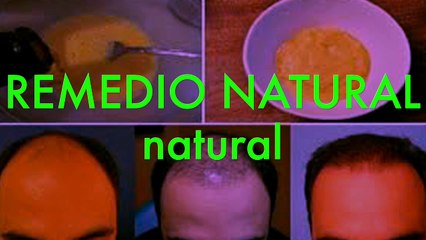 Aplica cerveza y plátano en tu cabello y los resultados son increíbles!!