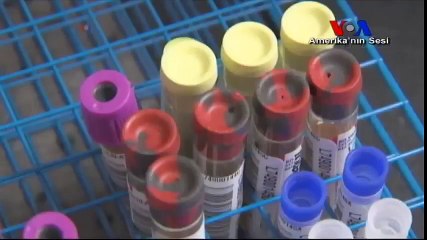 Kalp Krizi Riskini Belirleyen Kan Testi