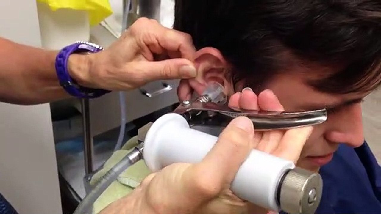 Ce spécialiste injecte de l'eau dans l'oreille de son patient. Ce qu'il va en ressortir est inimaginable !