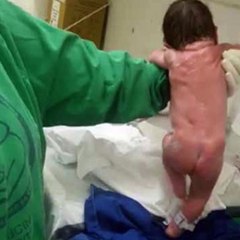 പിറന്ന ഉടനെ നടക്കണം.....!!!! #News60