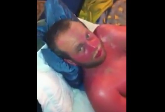 Régis est resté un peu trop au soleil !