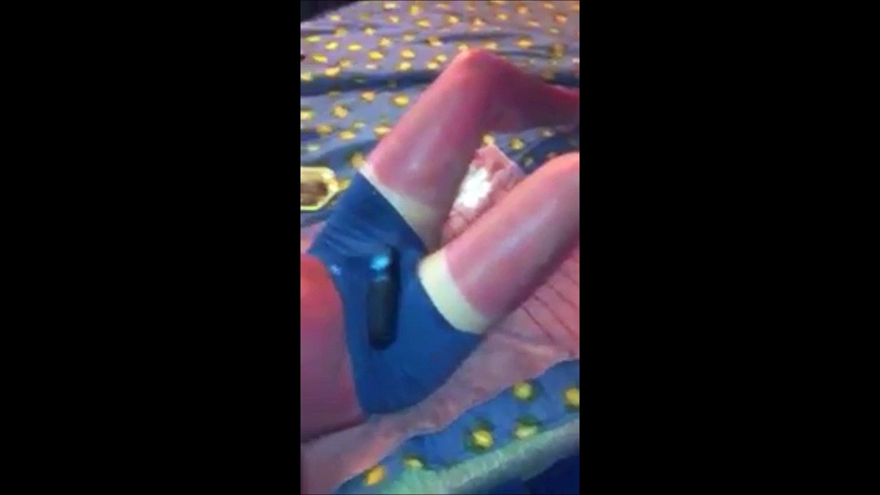 Il s'endort au soleil et prend un coup de soleil enorme et douloureux