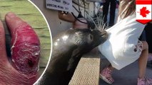 Gadis kecil yang digigit singa laut mungkin terkena infeksi - Tomonews