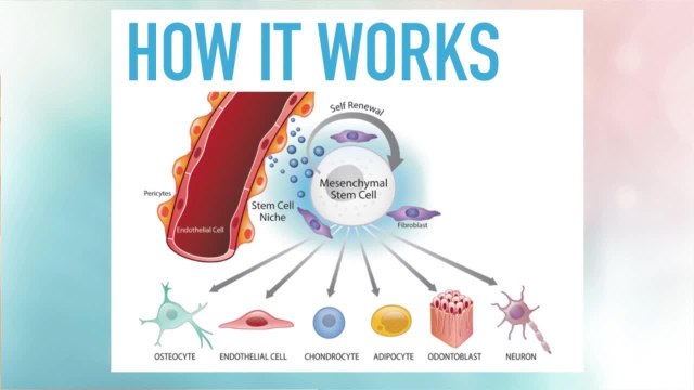 Source of Health: How stem cells can help heal joint pain