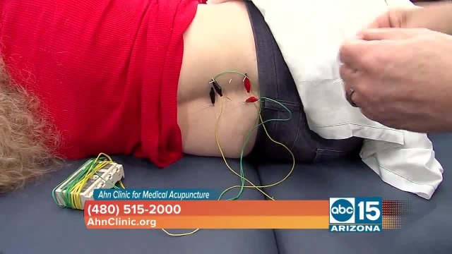 Dr. Yang Ahn uses medical acupuncture to treat all pain problems
