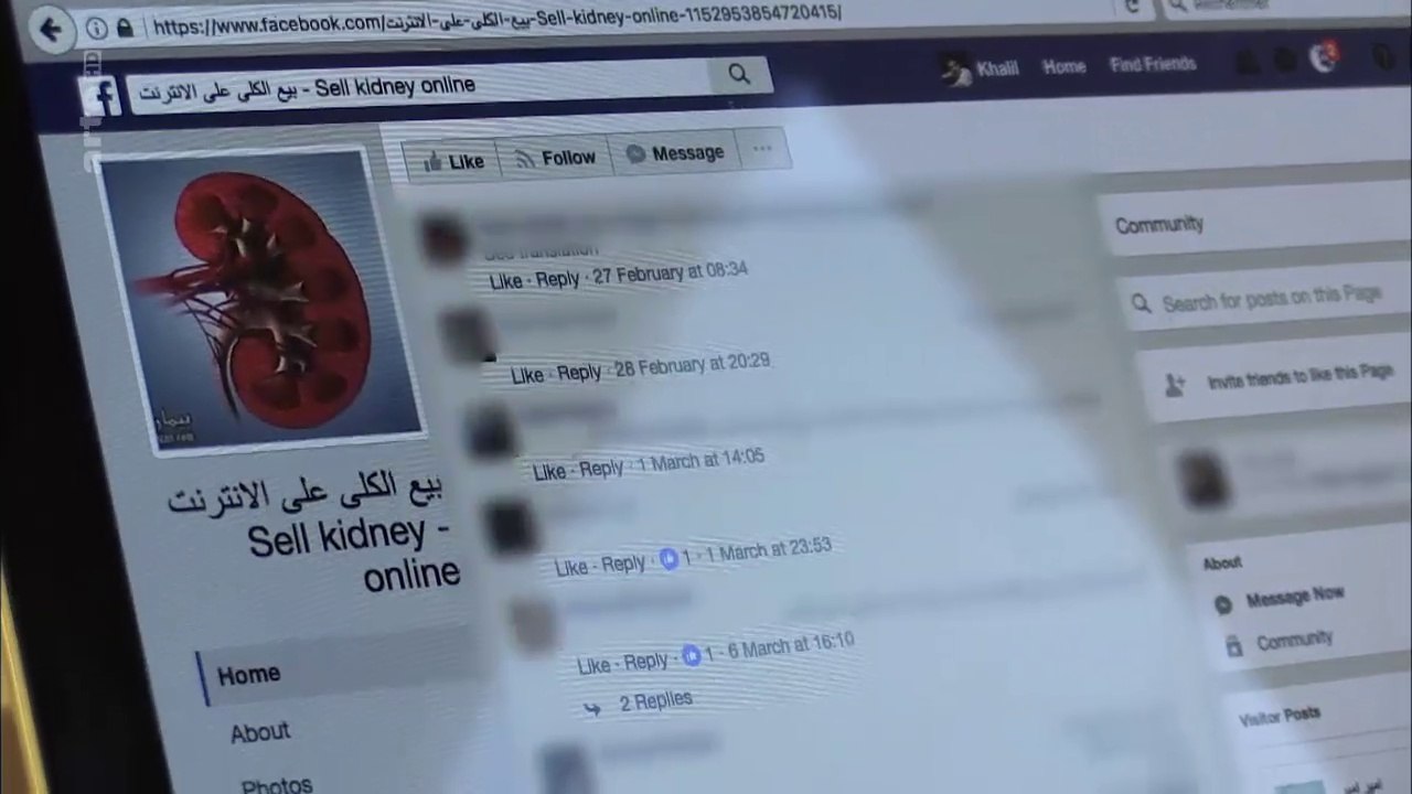 Türkei: Niere zu verkaufen