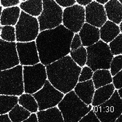 GEF4_clone