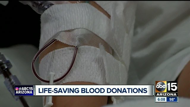 Need for blood donations grow in Arizona; toddler undergoes 22nd blood transfusion