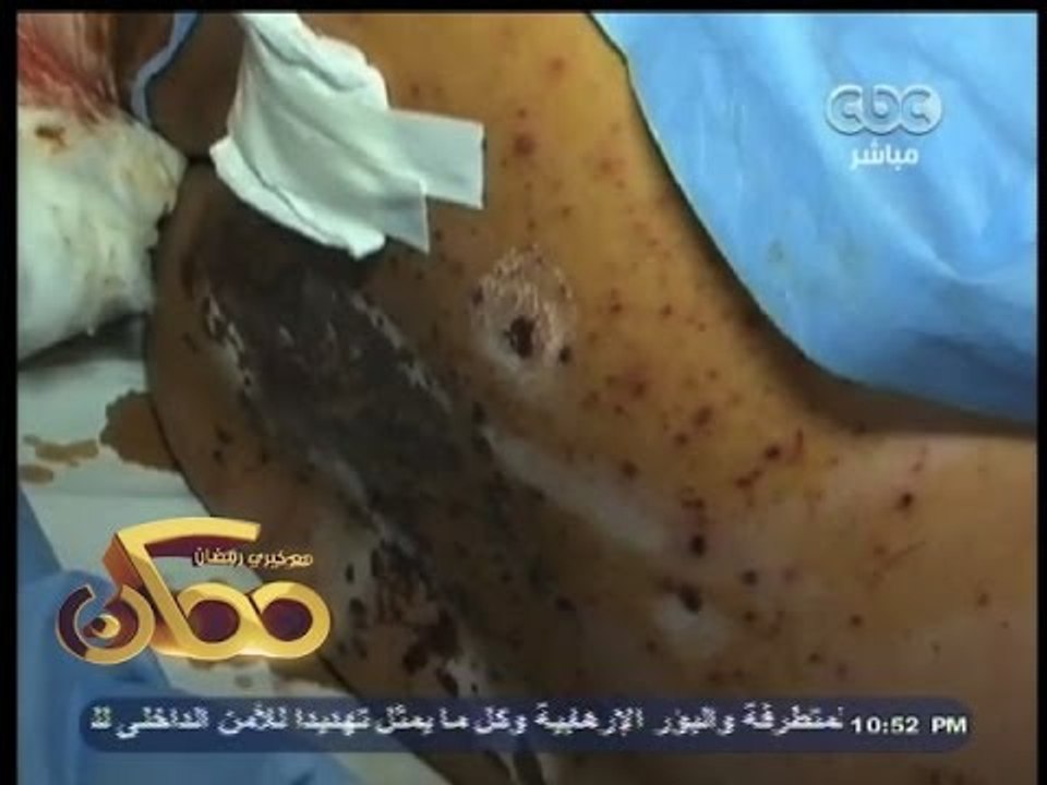 #ممكن | شاهد بالفيديو .. مصابو حادث محيط جامعة القاهرة يروون شهادتهم عن الحادث