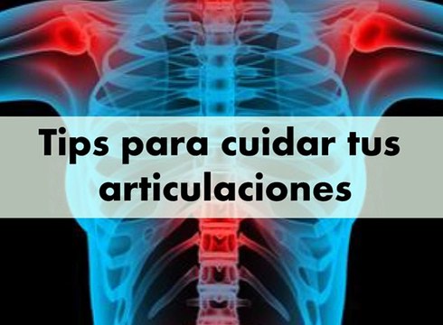 Daniel Esgardo Rangel Barón da consejos para el cuidado de las articulaciones