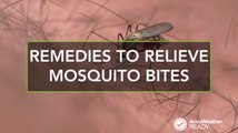 Best home remedies to relieve itchy mosquito bites