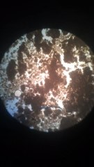 SVT - Bacteries yaourt