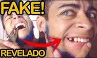 Everson Zóio Desmascarado !! Veja como ela armou desafio: Arrancando Dente com Alicate #60