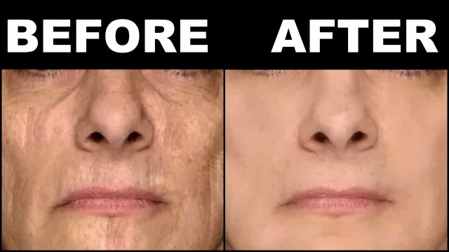 Anti-aging face mask for younger looking skin - Remove wrinkles fine lines easily