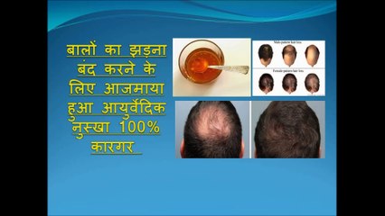 बालों का झड़ना बंद करने का के लिए आजमाया हुआ आयुर्वेदिक नुस्खा 100% कारगर Hair Loss Home Remedy
