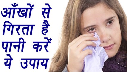 Watery Eye | Home remedy for watery eyes |आँख से गिरता है पानी करें ये उपाय | Boldsky