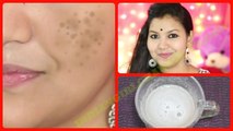100% effective-remove dark spots, black spots, pigmentation fast-get spotless skin