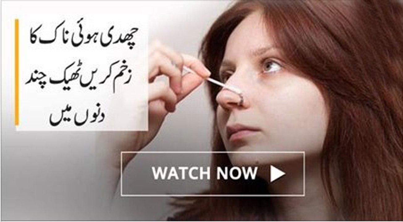 How to Treat an Infected Nose Piercing