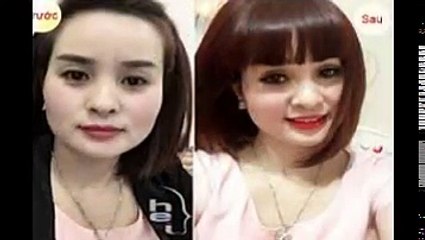 Bấm mí Hàn Quốc công nghệ chăm sóc sắc đẹp tiên tiến