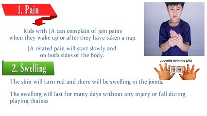 Juvenile Rheumatoid Arthritis