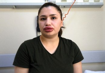 Merve Hemşireyi Mağdur Eden Sahte Estetikçi Kuaföre 5 Yıla Kadar Hapis İstendi