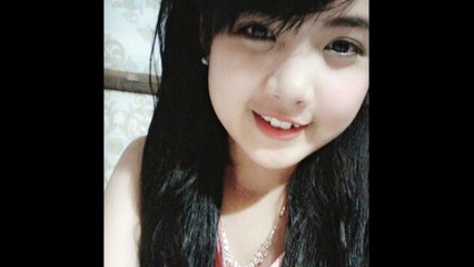 căng da mặt nội soi giá bao nhiêu