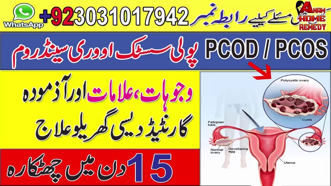 PCOS Causes And Treatement Home Remedy To Cure Ploycystic Ovary Syndrome