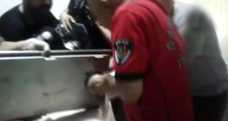 Kıyma Makinesiyle Hastaneye Kaldırılan Kadın İçin İtfaiye Çağırıldı