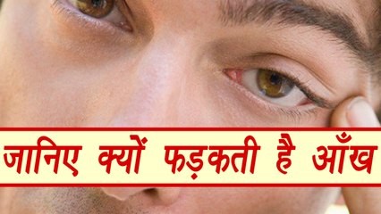 आँख का फड़कना है सेहत से जुड़ा, Twitching of Eye tells THIS about your Health | Boldsky