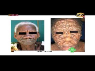 Sen Sante du samedi 28 janv. 2017