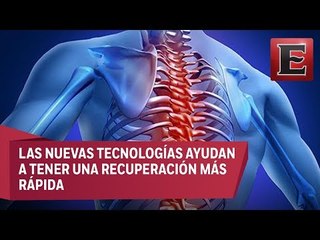 Lo que necesitas saber de la operación de columna