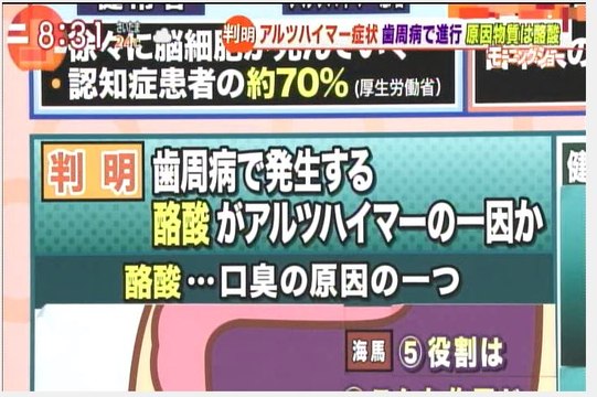 歯周病はアルツハイマー病を促進し「万病のもと」全身にリスクが有る
