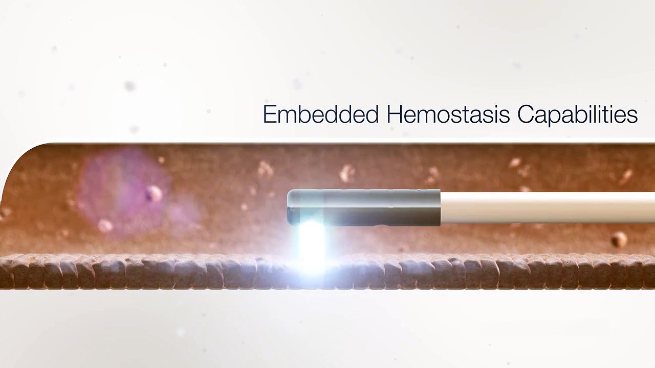 Holmium Surgical Laser â€“ Lumenis Pulse 120H