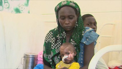 تشاد ومعاناة نقص الغذاء