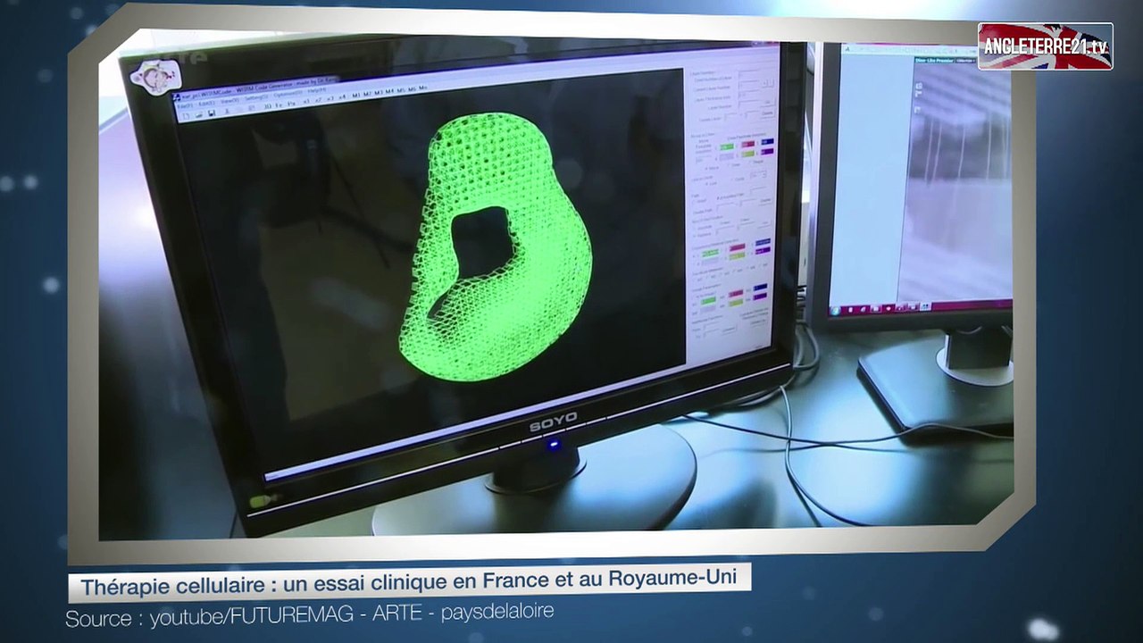 Thérapie cellulaire : un essai clinique en France et au Royaume-Uni