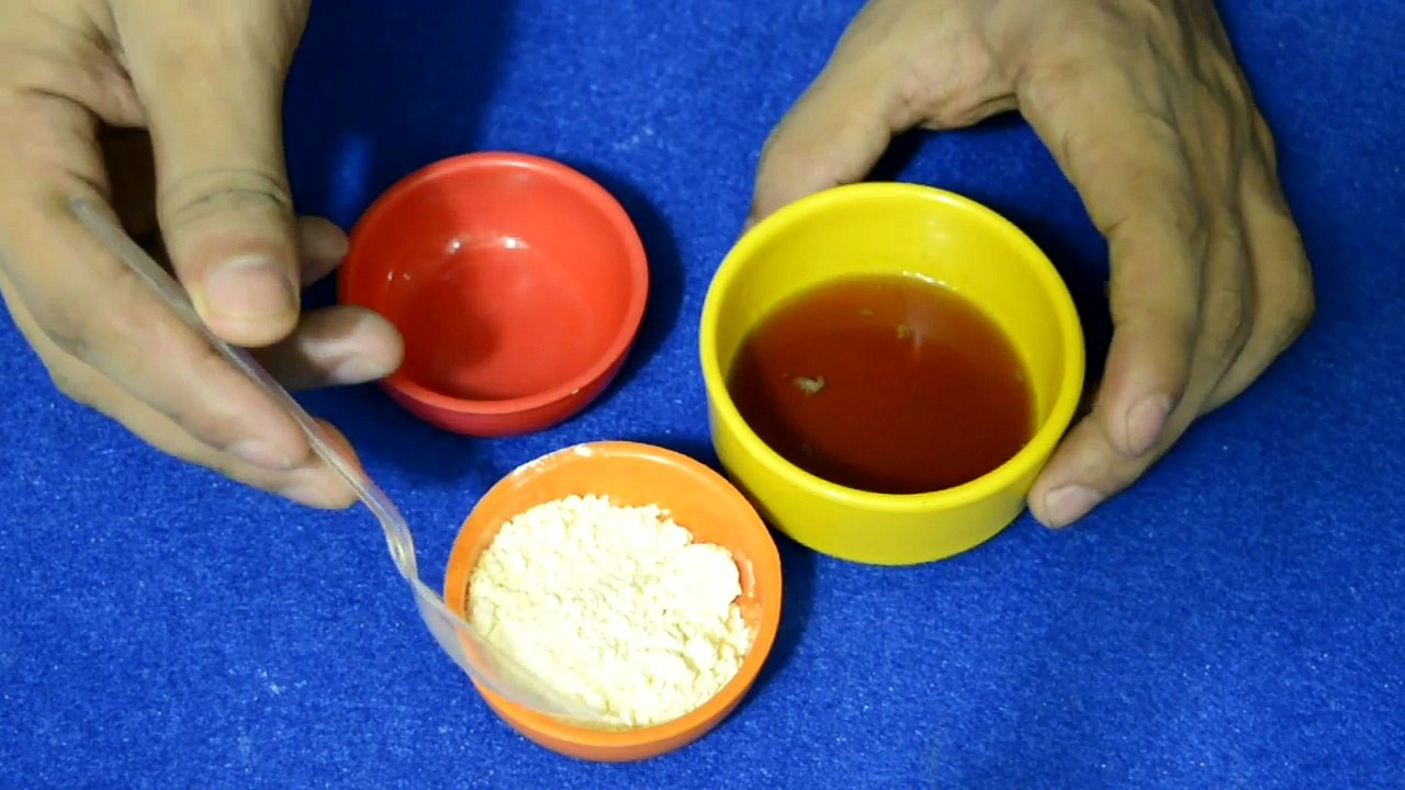 Dandruff treatment at home  2 दिन में पायें रुसी से छुटकारा