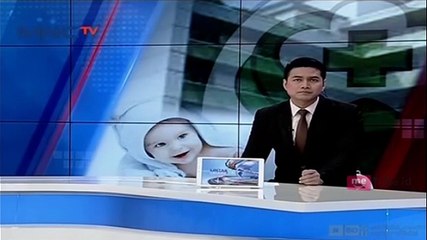 Sofia Dila Menderita Hidrosefalus Sejak Lahir