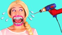 Frozen Elsa Gets BRACES! w_ Spiderman Maleficent Princess Rapunzel Anna Toys! Superhero Fun _)