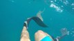 Un requin vient mordre la jambe de ce plongeur en Floride
