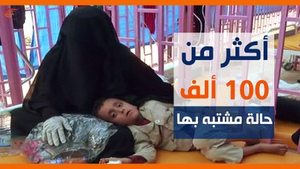 ماذا ولماذا؟: اليونيسيف تُحذّر: اليمن تحتضر!