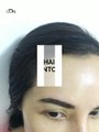 Fixing Hairline Contours with Korean Semipermanent Makeup Training | OUNI