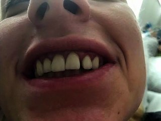 URADILA ZUBE U BOSNI: Nakon nekog vremena uslijedio je ŠOK