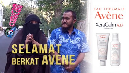 AVENE, Selamatkan Indadari dari Penyakit Kulit Langka - Cumicam 09 Juni 2017