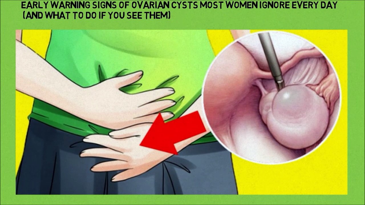 Early Warning Signs Of Ovarian Cysts Most Women Ignore Every Day And What To Do If You See Them