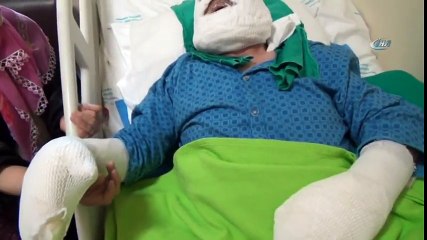 Yaşlı Adam Yemek Isıtayım Derken Bu Hale Geldi